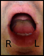 DL Tongue In - 1